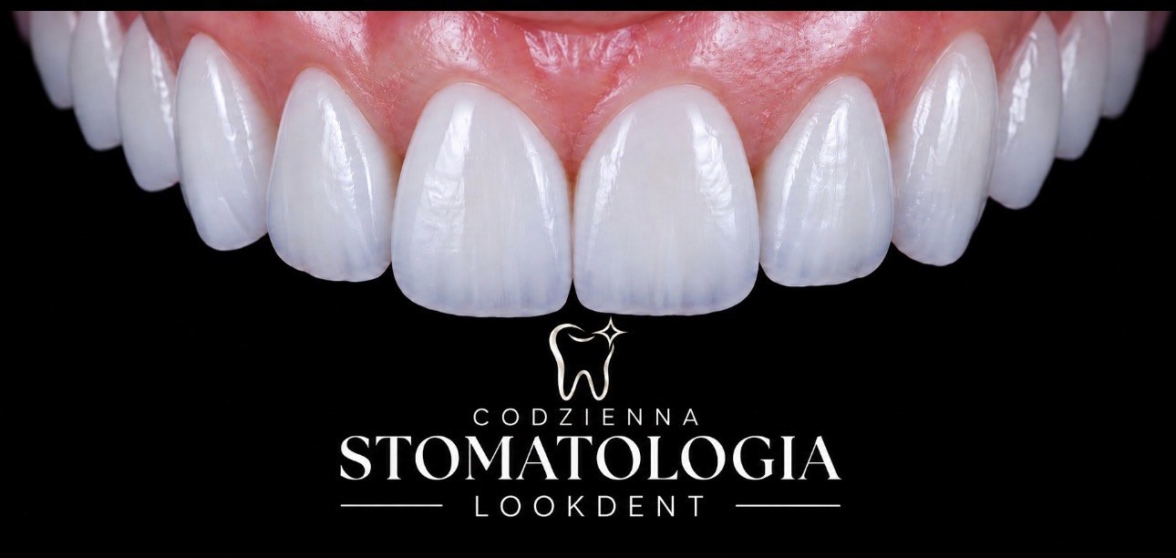 Codzienna Stomatologia Lookdent - logo na tle licówek
